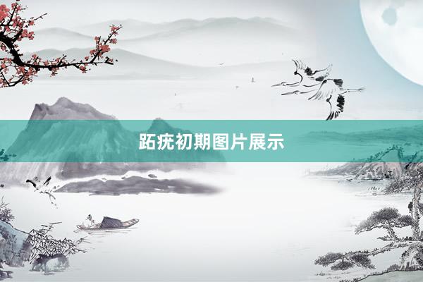 跖疣初期图片展示